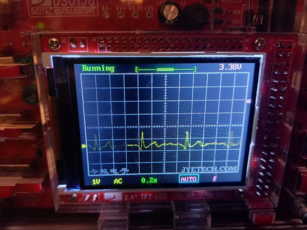 Señal del ECG mostrada en un osciloscopio